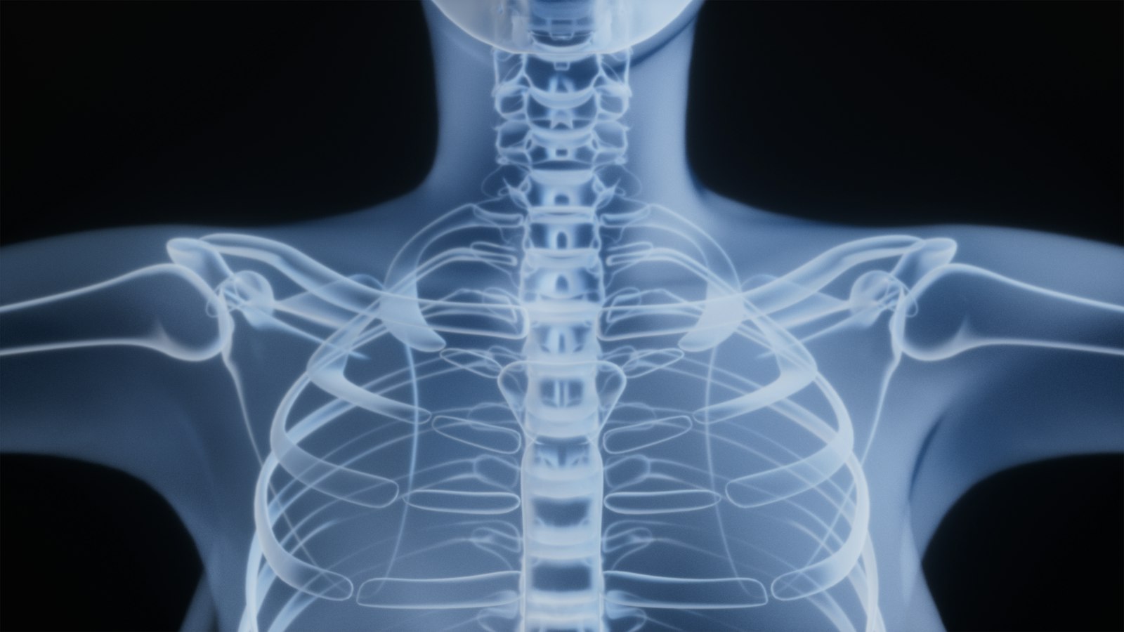 Radiografia (raio-X) do tórax e ombros humanos, relacionada à saúde óssea